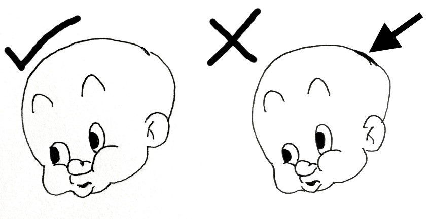 מדוע לא לתקן טעויות בעט